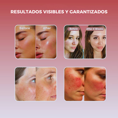 Mascarilla Cóllageno Beauty